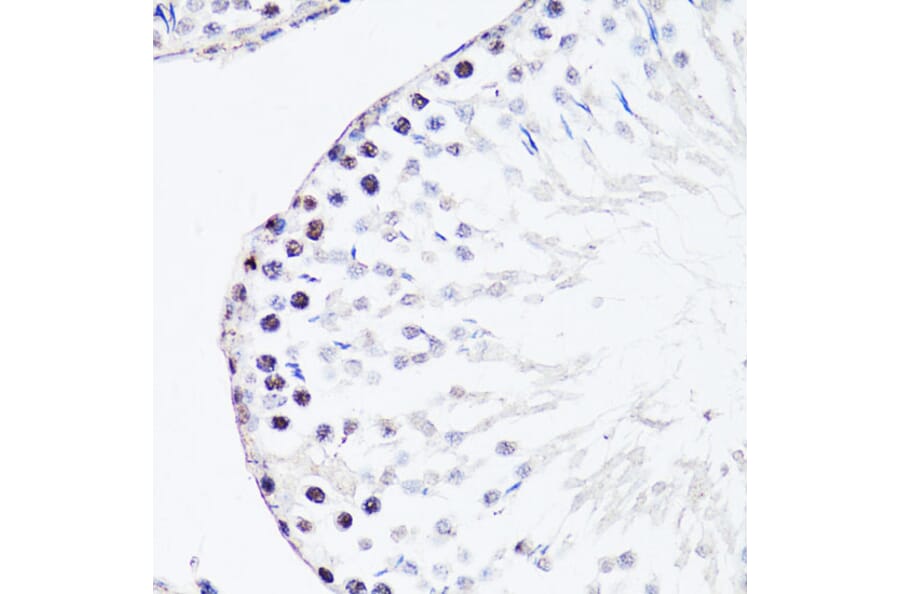 Immunohistochemistry - Anti-FGF12 Antibody (A17193) - Antibodies.com