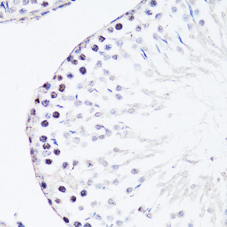 Immunohistochemistry - Anti-FGF12 Antibody (A17193) - Antibodies.com