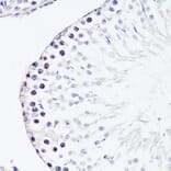 Immunohistochemistry - Anti-FGF12 Antibody (A17193) - Antibodies.com