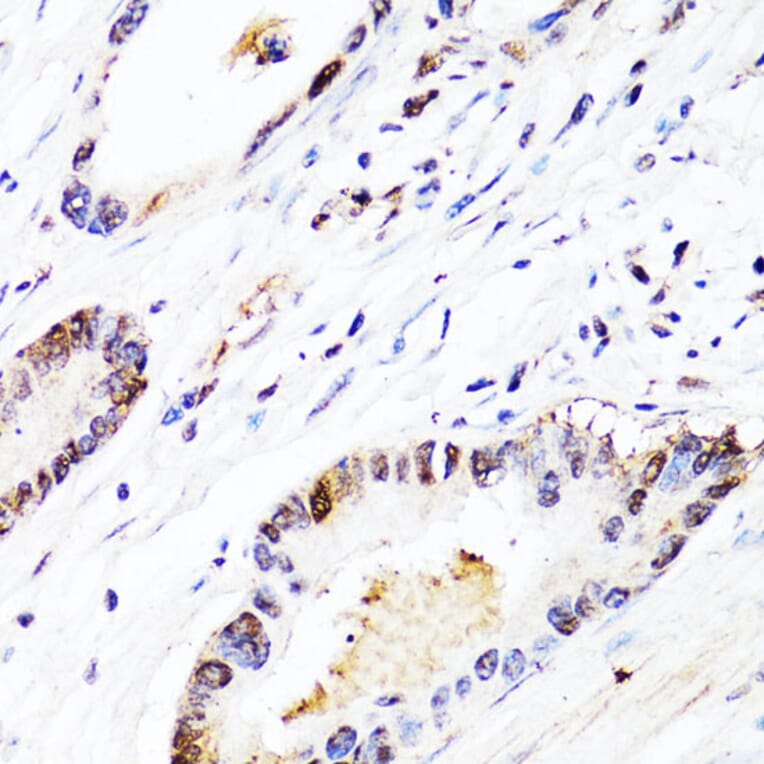 Immunohistochemistry - Anti-FGF12 Antibody (A17193) - Antibodies.com