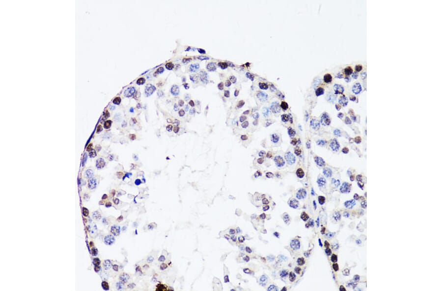 Immunohistochemistry - Anti-FGF12 Antibody (A17193) - Antibodies.com