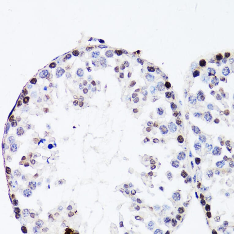 Immunohistochemistry - Anti-FGF12 Antibody (A17193) - Antibodies.com