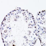 Immunohistochemistry - Anti-FGF12 Antibody (A17193) - Antibodies.com