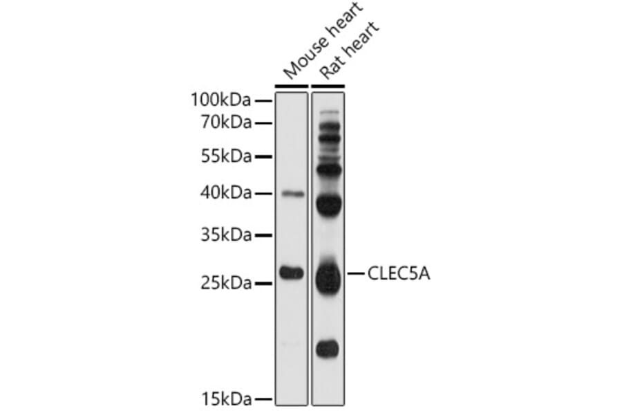 Western Blot - Anti-CLEC5A Antibody (A17194) - Antibodies.com