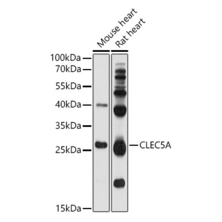 Western Blot - Anti-CLEC5A Antibody (A17194) - Antibodies.com