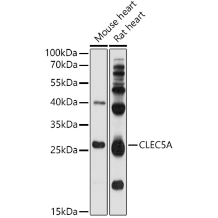 Western Blot - Anti-CLEC5A Antibody (A17194) - Antibodies.com
