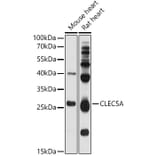 Western Blot - Anti-CLEC5A Antibody (A17194) - Antibodies.com