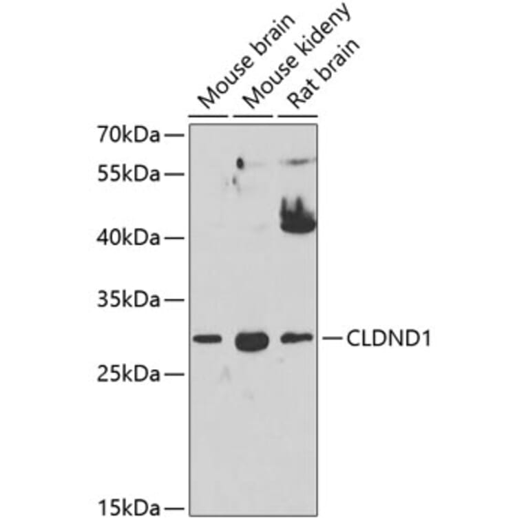 Western Blot - Anti-CLDND1 Antibody (A17195) - Antibodies.com