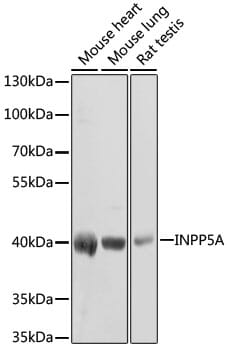 Western blot analysis of extracts of various cell lines, using Anti-INPP5A Antibody (A3302) at 1:1,000 dilution.
Secondary antibody: Goat Anti-Rabbit IgG (H+L) (HRP) (AS014) at 1:10,000 dilution.
Lysates / proteins: 25µg per lane.
Blocking buffer: 3% non-fat dry milk in TBST.
Detection: ECL Basic Kit (RM00020).
Exposure time: 30s.