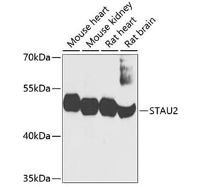 Western Blot - Anti-STAU2 Antibody (A17198) - Antibodies.com