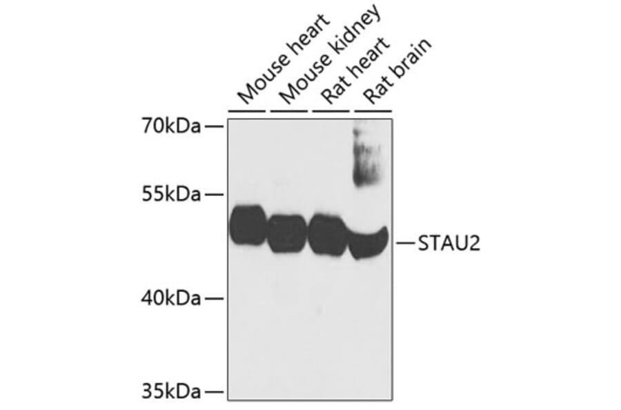 Western Blot - Anti-STAU2 Antibody (A17198) - Antibodies.com