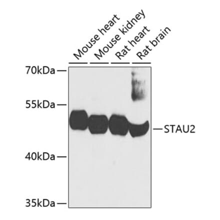 Western Blot - Anti-STAU2 Antibody (A17198) - Antibodies.com