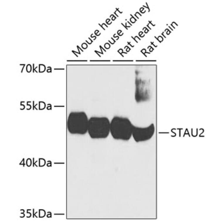 Western Blot - Anti-STAU2 Antibody (A17198) - Antibodies.com