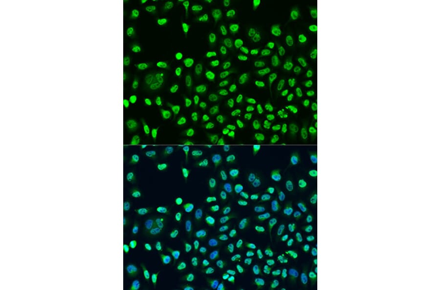 Immunofluorescence - Anti-STAU2 Antibody (A17198) - Antibodies.com