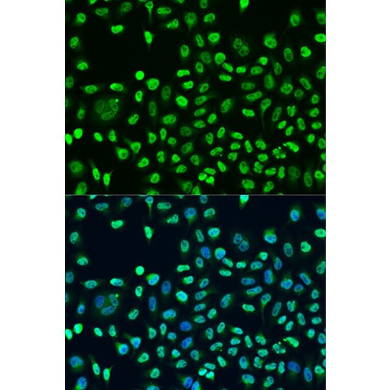 Immunofluorescence - Anti-STAU2 Antibody (A17198) - Antibodies.com