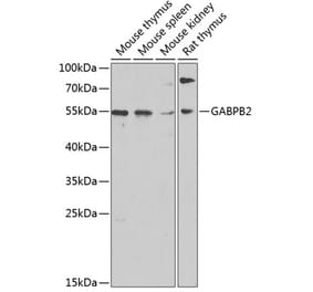 Western Blot - Anti-GABPB2 Antibody (A17200) - Antibodies.com