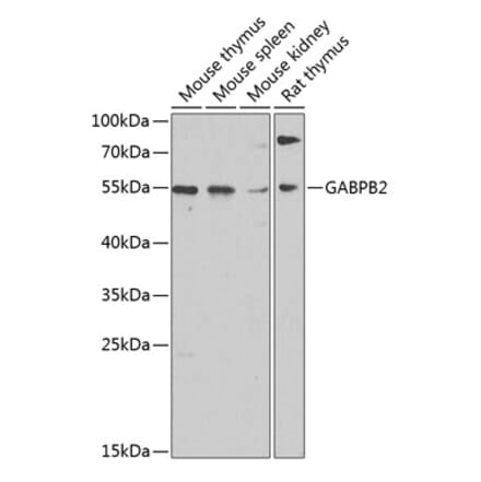 Western Blot - Anti-GABPB2 Antibody (A17200) - Antibodies.com