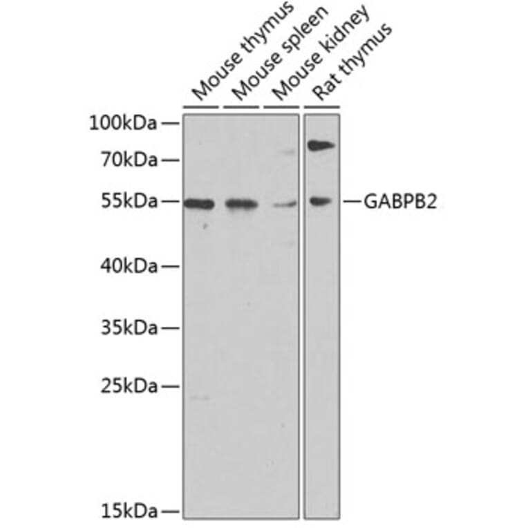 Western Blot - Anti-GABPB2 Antibody (A17200) - Antibodies.com