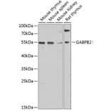 Western Blot - Anti-GABPB2 Antibody (A17200) - Antibodies.com