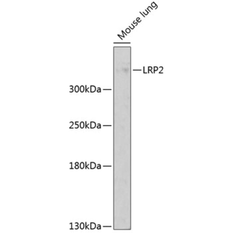 Western Blot - Anti-Lrp2/Megalin Antibody (A17201) - Antibodies.com