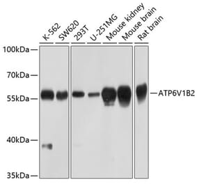 Western Blot - Anti-ATP6V1B2 Antibody (A17202) - Antibodies.com