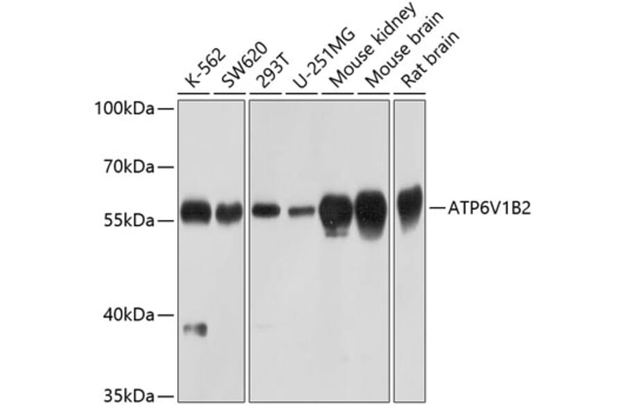 Western Blot - Anti-ATP6V1B2 Antibody (A17202) - Antibodies.com