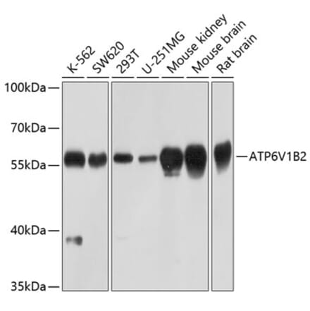 Western Blot - Anti-ATP6V1B2 Antibody (A17202) - Antibodies.com