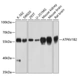 Western Blot - Anti-ATP6V1B2 Antibody (A17202) - Antibodies.com