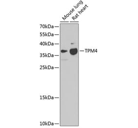 Western Blot - Anti-TPM4 Antibody (A17204) - Antibodies.com
