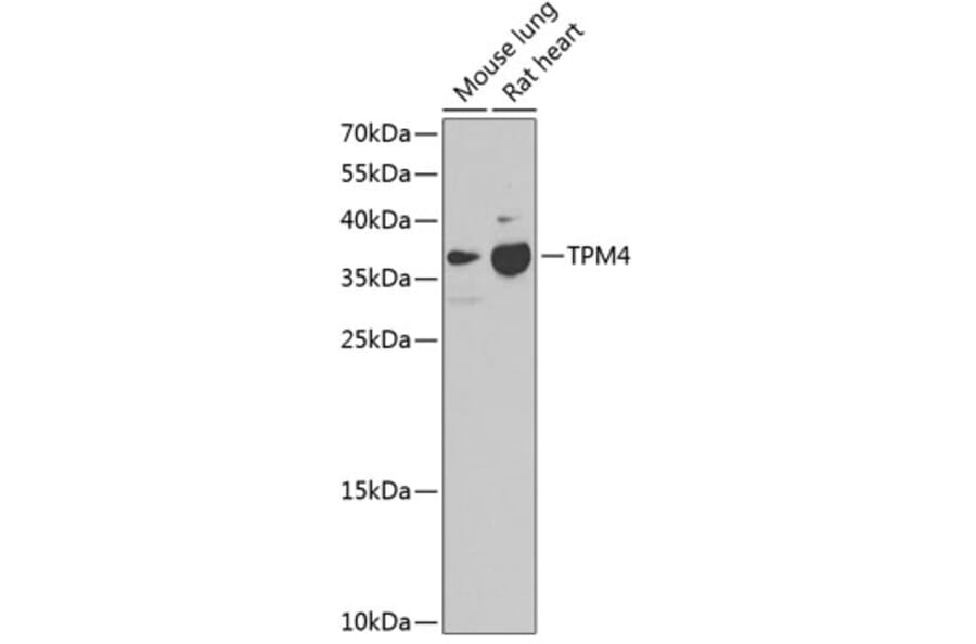 Western Blot - Anti-TPM4 Antibody (A17204) - Antibodies.com