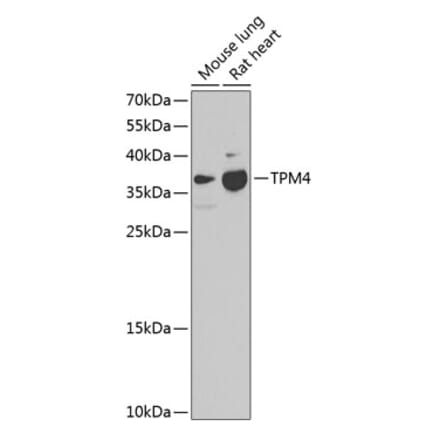 Western Blot - Anti-TPM4 Antibody (A17204) - Antibodies.com