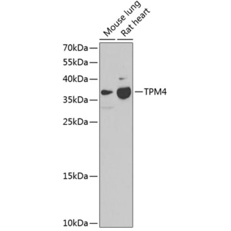 Western Blot - Anti-TPM4 Antibody (A17204) - Antibodies.com