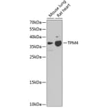Western Blot - Anti-TPM4 Antibody (A17204) - Antibodies.com
