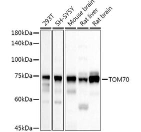 Western Blot - Anti-TOM70 Antibody (A17205) - Antibodies.com