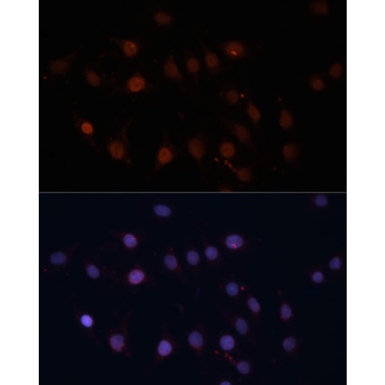 Immunofluorescence - Anti-TOM70 Antibody (A17205) - Antibodies.com