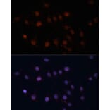 Immunofluorescence - Anti-TOM70 Antibody (A17205) - Antibodies.com