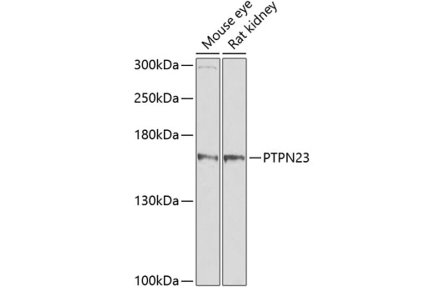 Western Blot - Anti-HDPTP Antibody (A17206) - Antibodies.com
