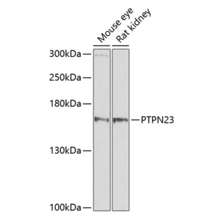 Western Blot - Anti-HDPTP Antibody (A17206) - Antibodies.com