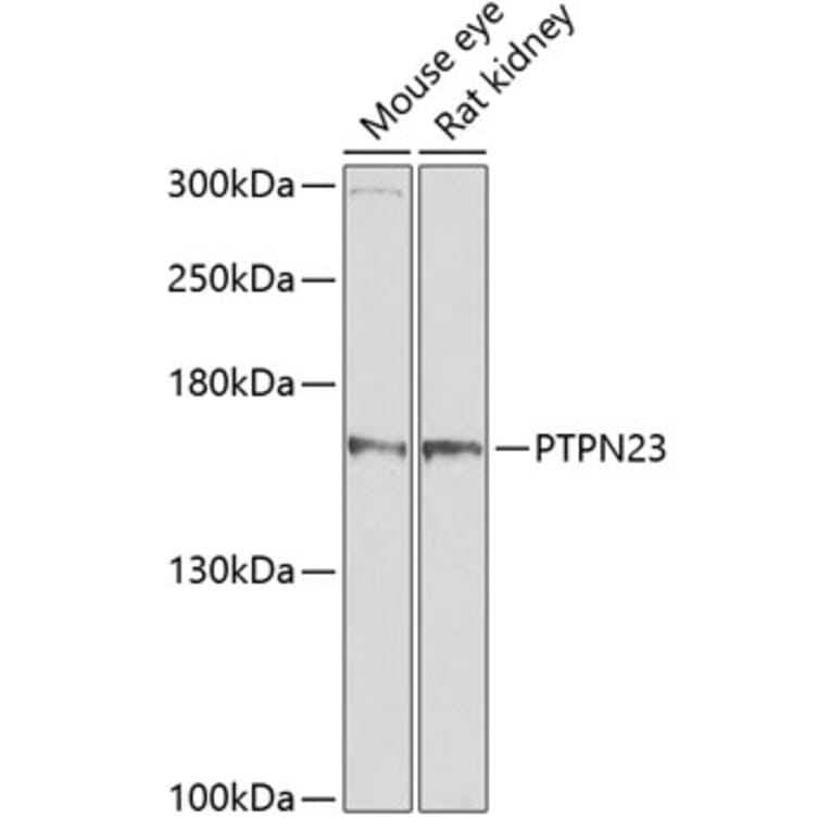 Western Blot - Anti-HDPTP Antibody (A17206) - Antibodies.com