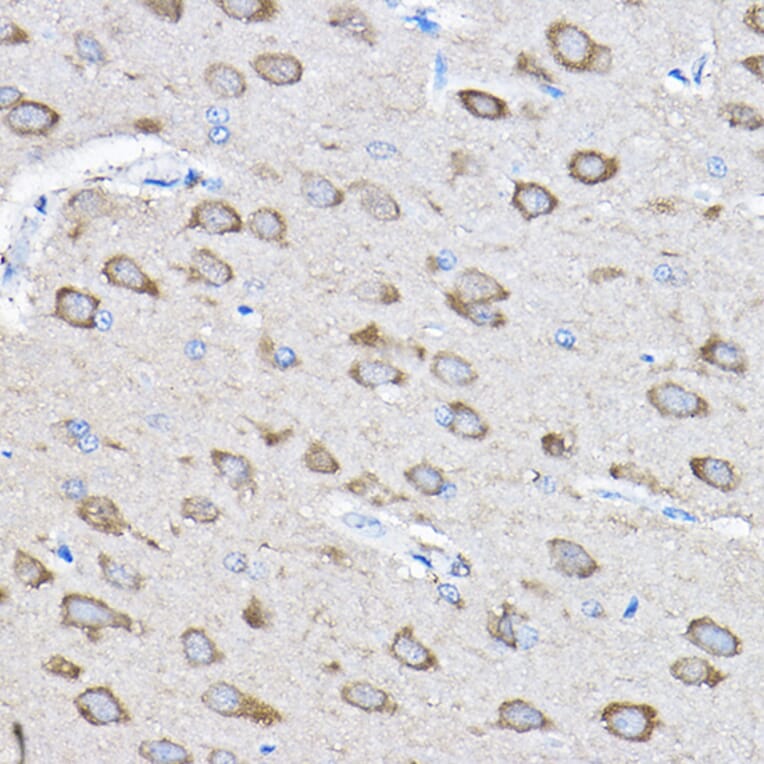 Immunohistochemistry - Anti-HDPTP Antibody (A17206) - Antibodies.com