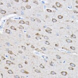 Immunohistochemistry - Anti-HDPTP Antibody (A17206) - Antibodies.com
