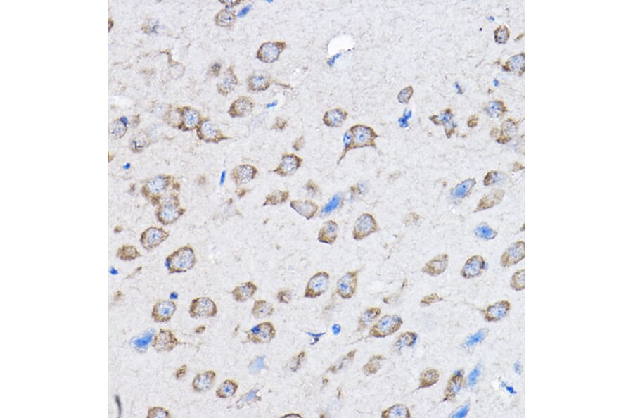 Immunohistochemistry - Anti-HDPTP Antibody (A17206) - Antibodies.com