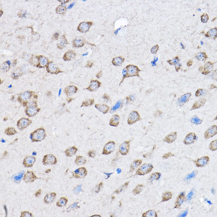 Immunohistochemistry - Anti-HDPTP Antibody (A17206) - Antibodies.com
