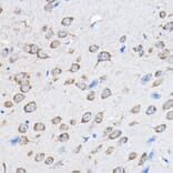 Immunohistochemistry - Anti-HDPTP Antibody (A17206) - Antibodies.com