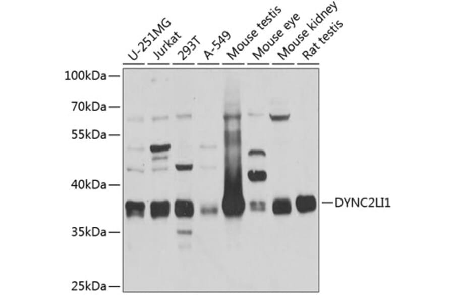 Western Blot - Anti-DYNC2LI1 Antibody (A17208) - Antibodies.com