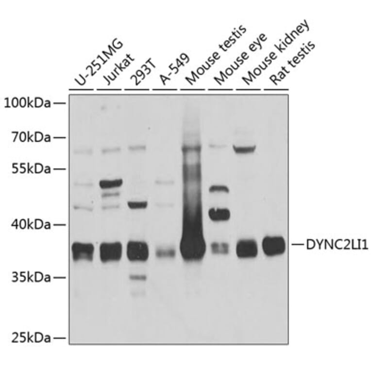 Western Blot - Anti-DYNC2LI1 Antibody (A17208) - Antibodies.com