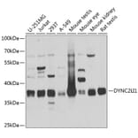 Western Blot - Anti-DYNC2LI1 Antibody (A17208) - Antibodies.com