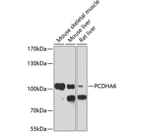 Western Blot - Anti-PCDHA6 Antibody (A17209) - Antibodies.com