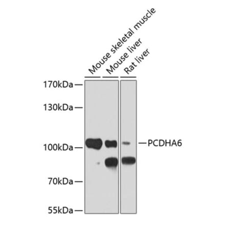 Western Blot - Anti-PCDHA6 Antibody (A17209) - Antibodies.com