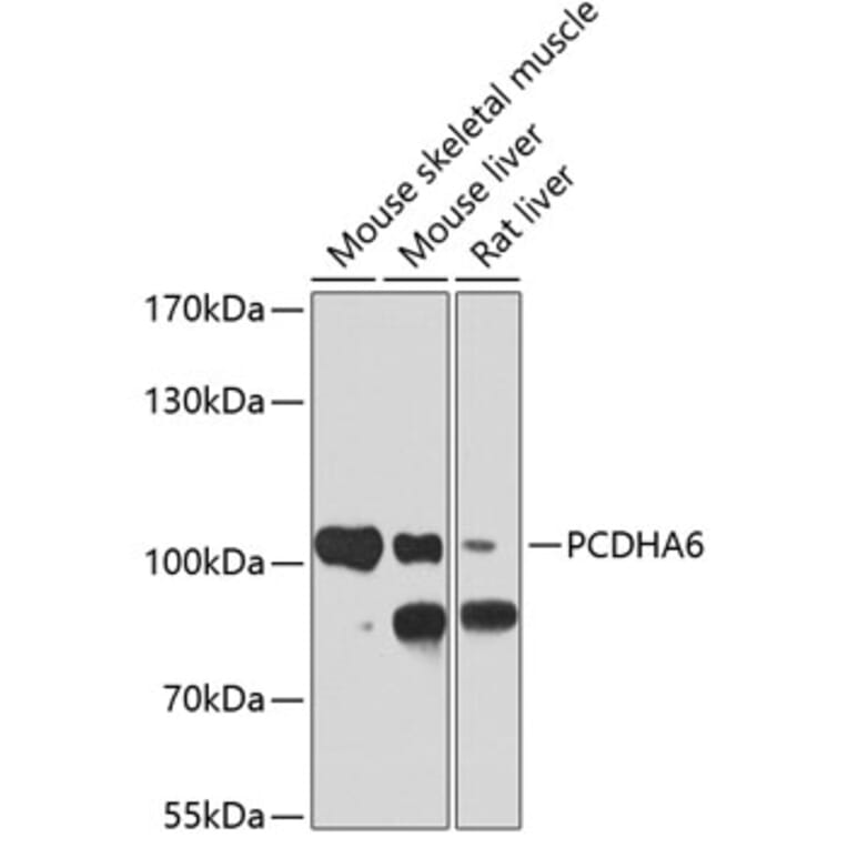 Western Blot - Anti-PCDHA6 Antibody (A17209) - Antibodies.com